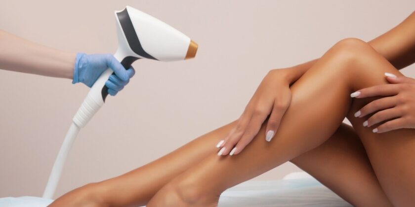 Epilare laser
