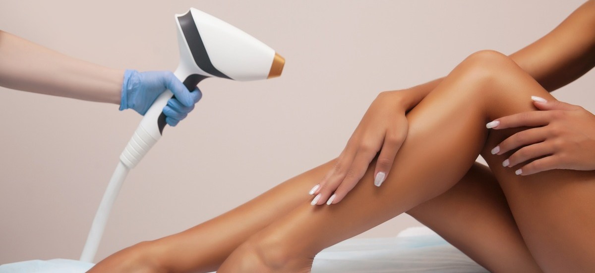 Epilare laser